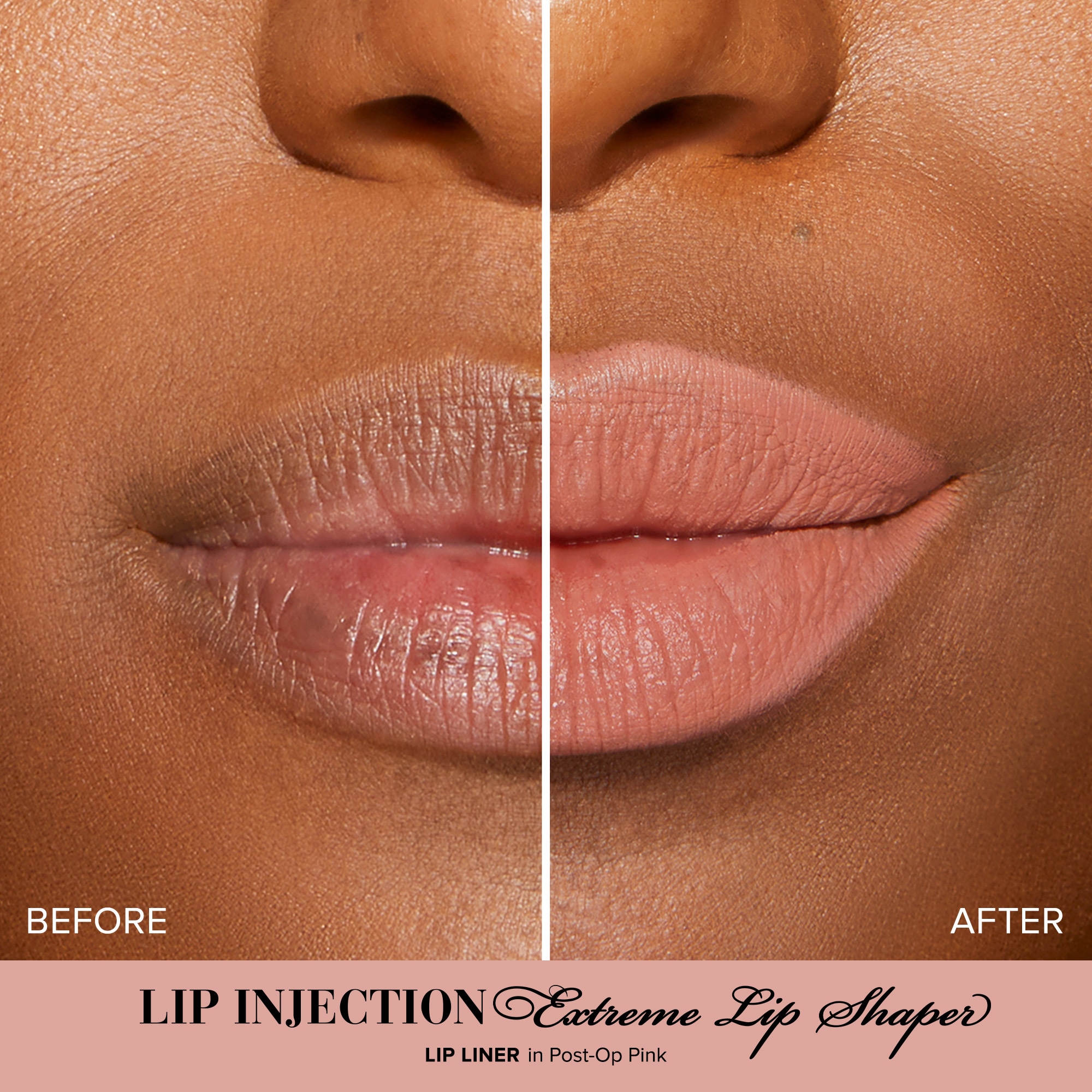 Lip Injection Extreme Lip Shaper