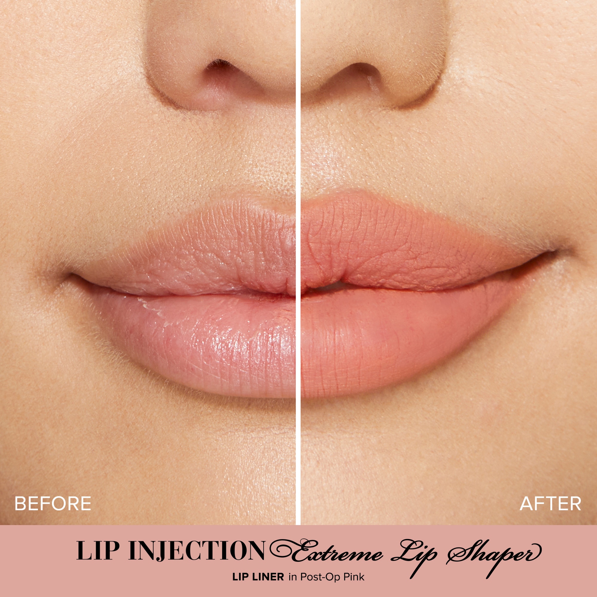 Lip Injection Extreme Lip Shaper