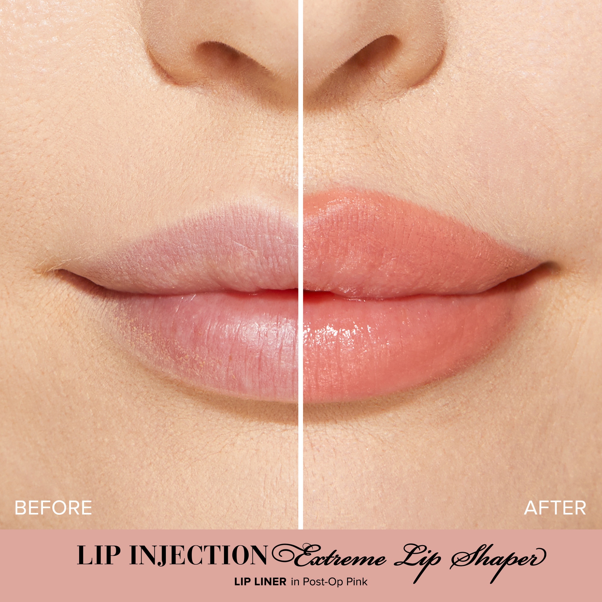 Lip Injection Extreme Lip Shaper