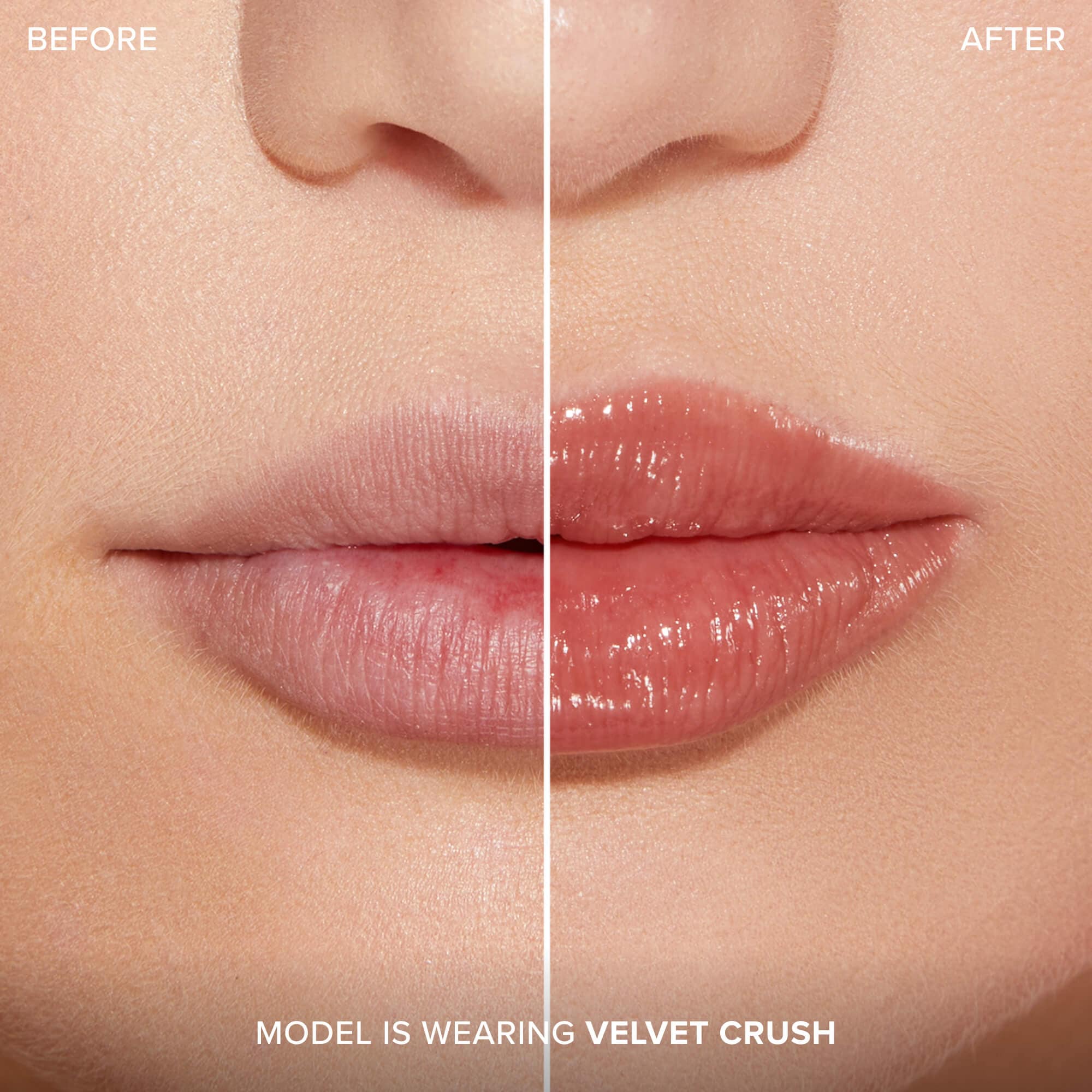 Lip Injection Extreme Plumping Clicks